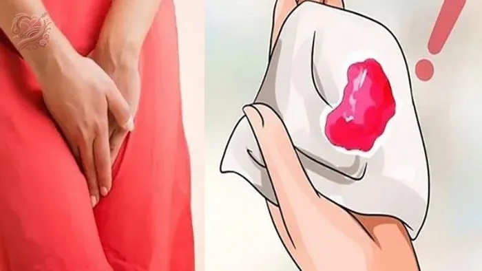 Khi nào cần gặp bác sĩ